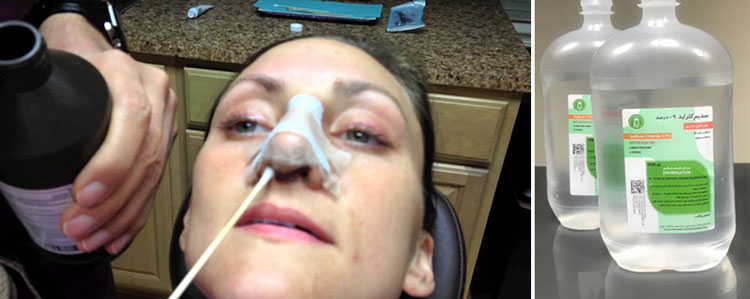 تمیز کردن بینی بعد از عمل